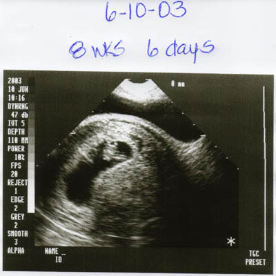 ultrasounds at 8 weeks. found a shot of 8 weeks,