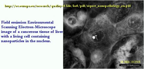 ESEM image of a cancerous tissue of liver with a living cell containing nanoparticles in the nucleus.