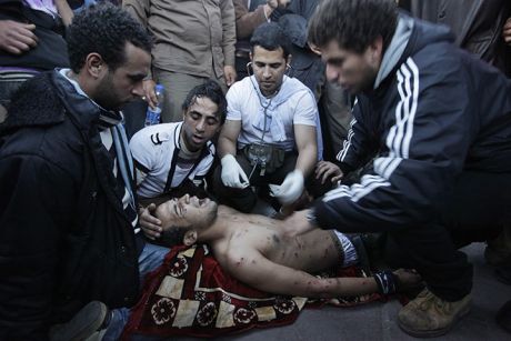 Protestors shot with metal pellets