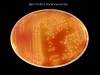 Did this bacteria deceive Pope Urban IV?