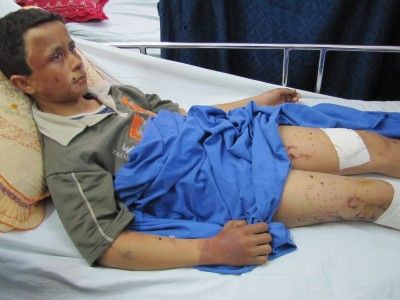 Hani Al-Qanoo, 15 We were coming back from school along with 6 of our companions when suddenly a drone hit us, said Hani. I had the sensation of flying.  The doctor told us that Hani has a fractured femur in his right leg and several burns caused by t
