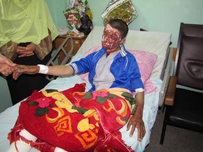 Moyad Al-Qanoo,  16  - injuries caused by second degree burns on the face and on the legs. He has shrapnel in various parts of his body.