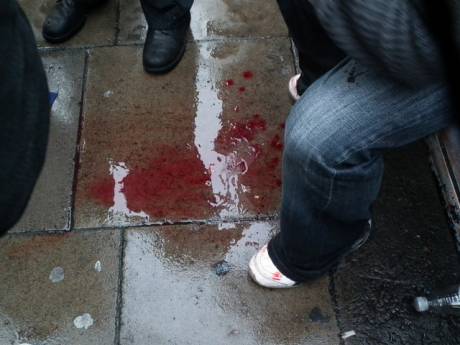 The future is the young people. Here we see the blood of the young people on the street