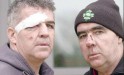 Martin & Pat O'Donnell photographed in the evening after the assault