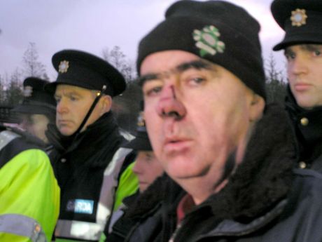 Pat O'Donnell showing his injuries before the Garda line