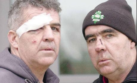 Click on image to see full-sized version Martin & Pat O'Donnell photographed in the evening after the assault